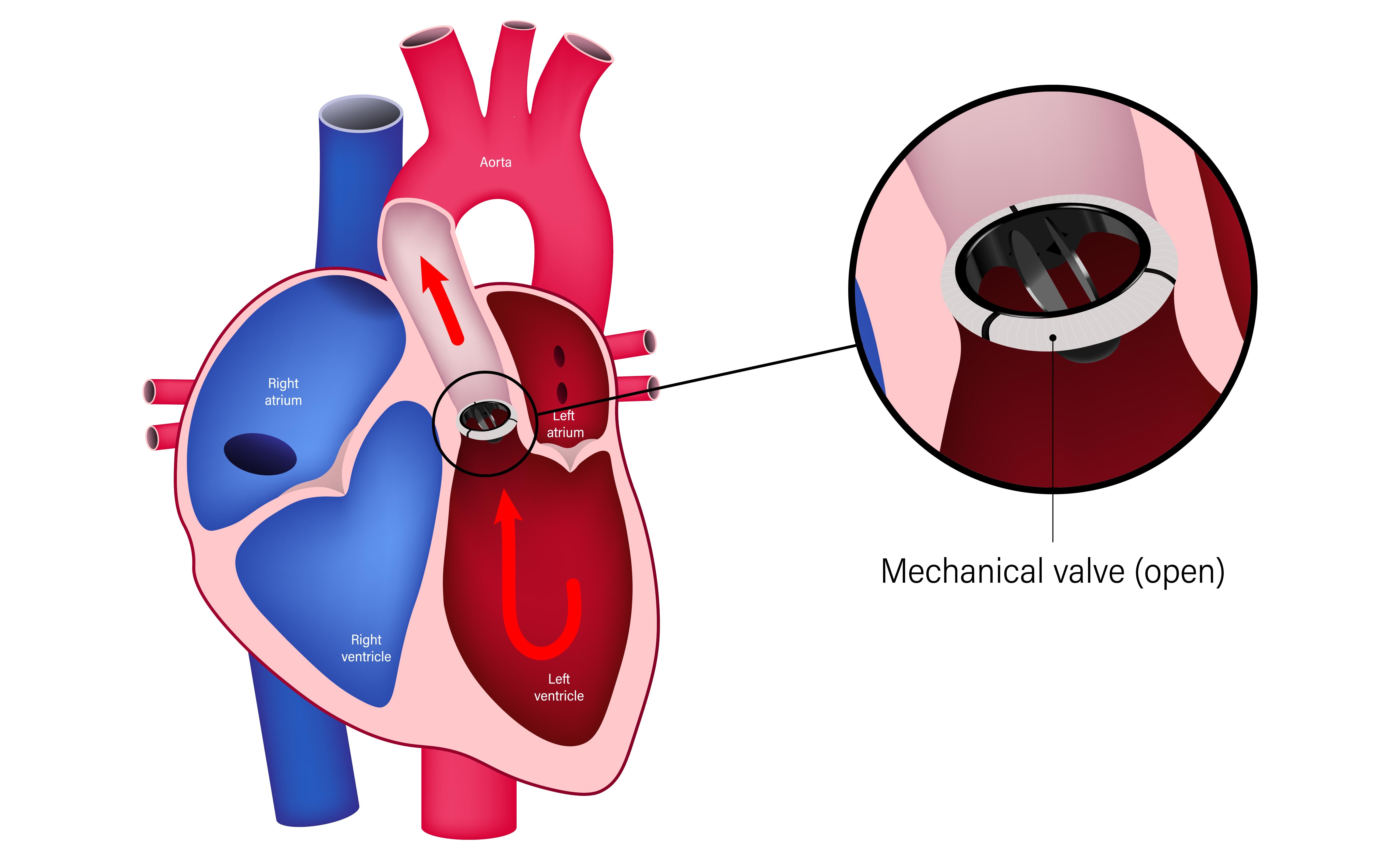 Understanding Heart Valves