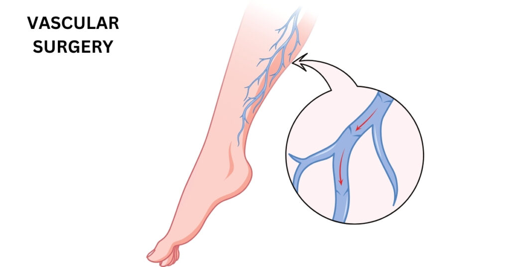 Vascular Surgery: Understanding Its Importance, Procedures, and Recovery